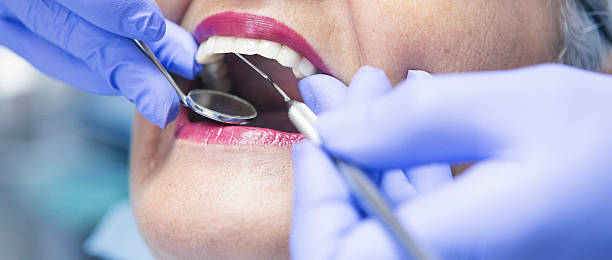 Best Emergency Care for Gum Disease in Wheatland, WY
